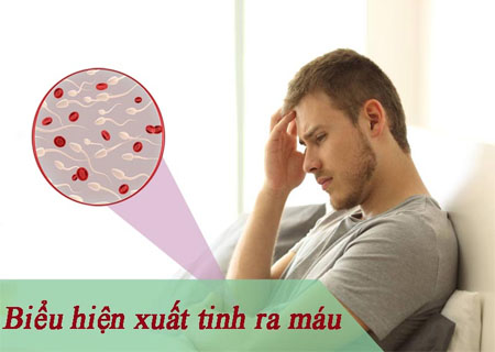 Những dấu hiệu cho thấy nam giới mắc bệnh xuất tinh ra máu