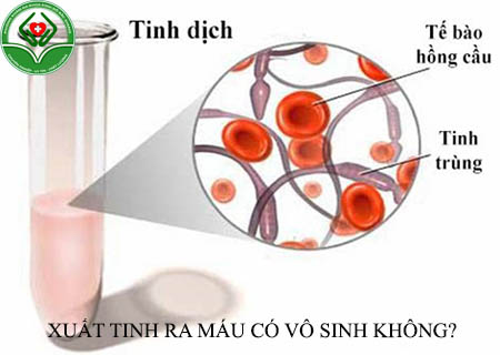 Xuất tinh ra máu có vô sinh không?