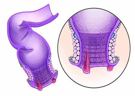 địa chỉ chữa đại tiện ra máu