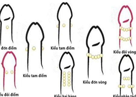 Phòng khám Kinh Đô thực hiện gắn bi vào chim hiệu quả