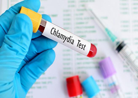 Xét nghiệm Chlamydia hết bao nhiêu tiền?