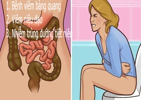 Bí tiểu do nhiều nguyên nhân gây nên